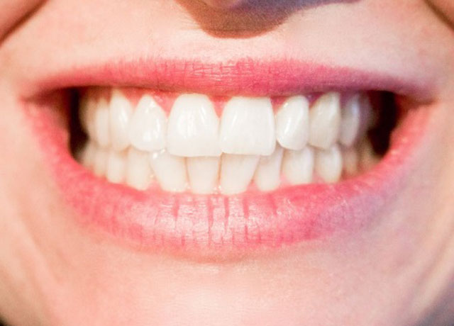 歯ぎしり する 人 の 特徴